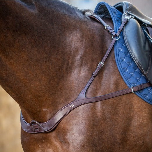 Anatomic breastplate